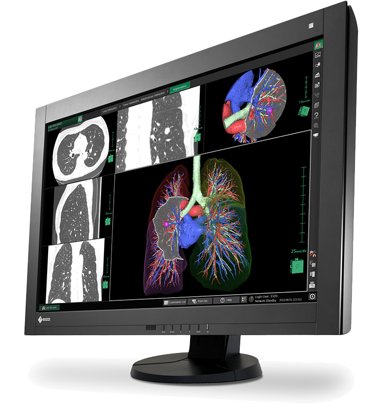 Eizo RadiForce RX440 | Parity Medical