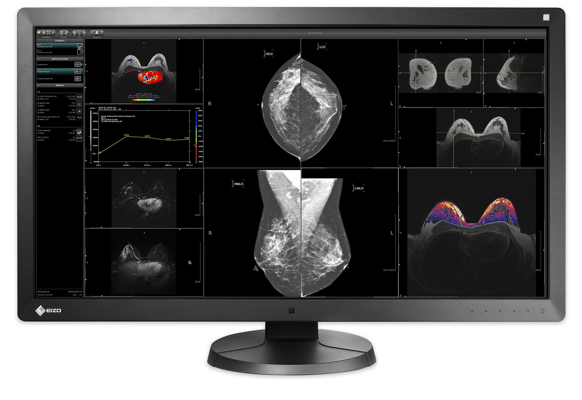 Eizo RadiForce RX850 | Parity Medical