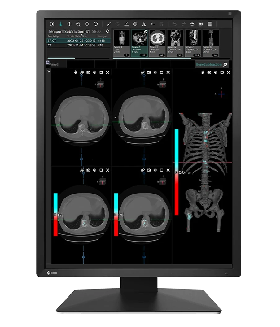 EIZO RadiForce MX217