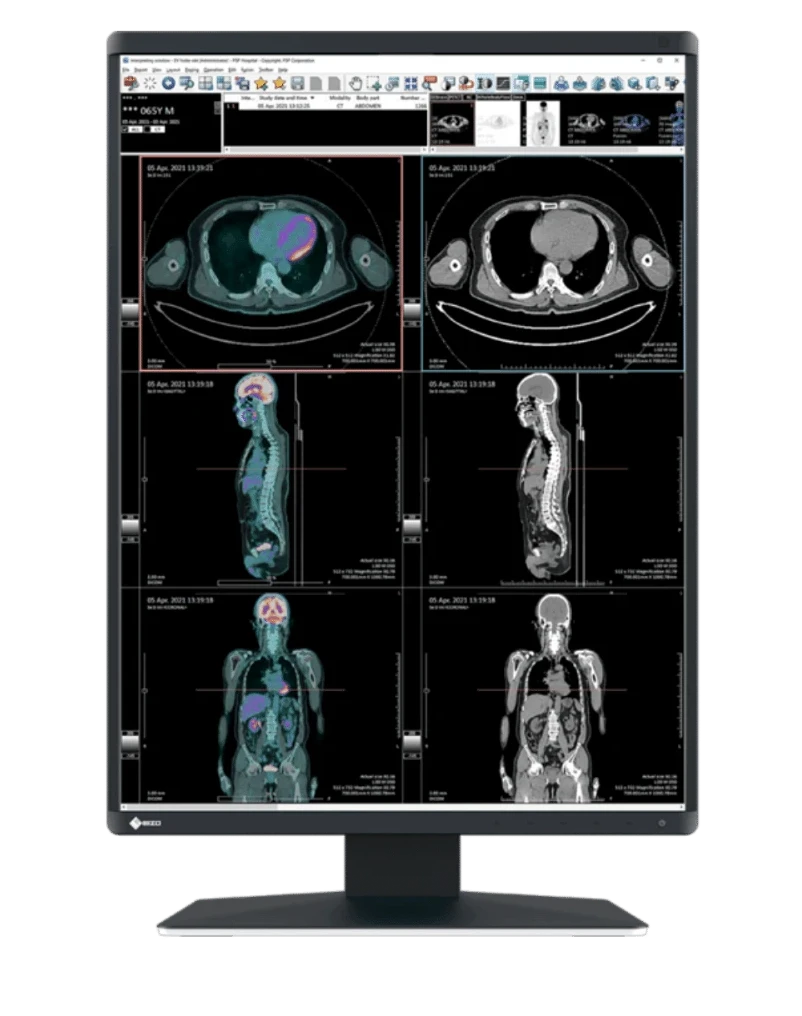 EIZO RadiForce RX370